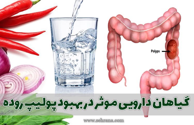 گیاهان دارویی موثر در بهبود پولیپ روده