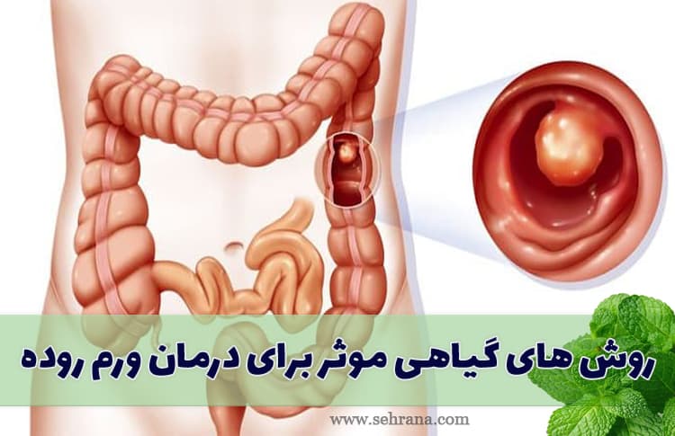 روش های گیاهی موثر برای درمان ورم روده