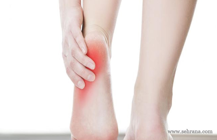 علائم درد پاشنه پا چیست