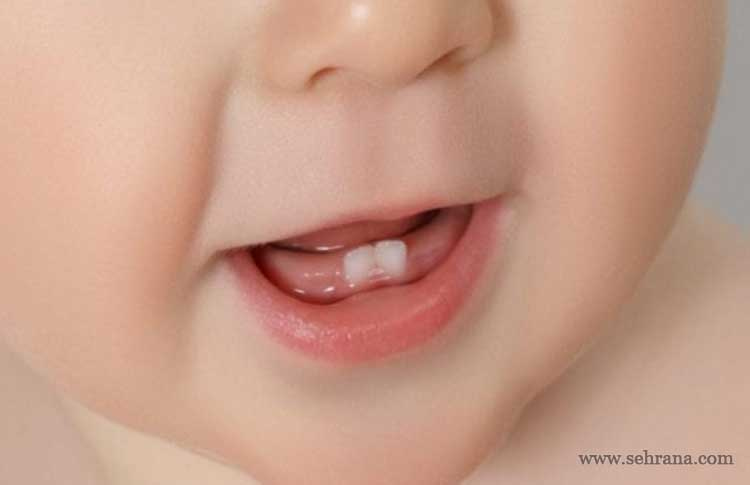 درست کردن دهانشویه برای نوزادان