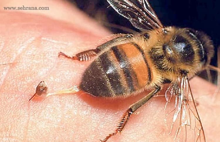 زهر زنبور عسل تصفیه شده