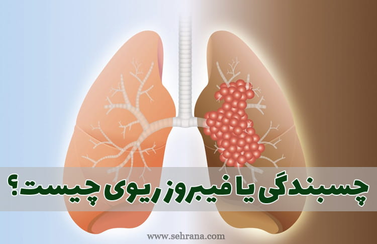 چسبندگی ریه