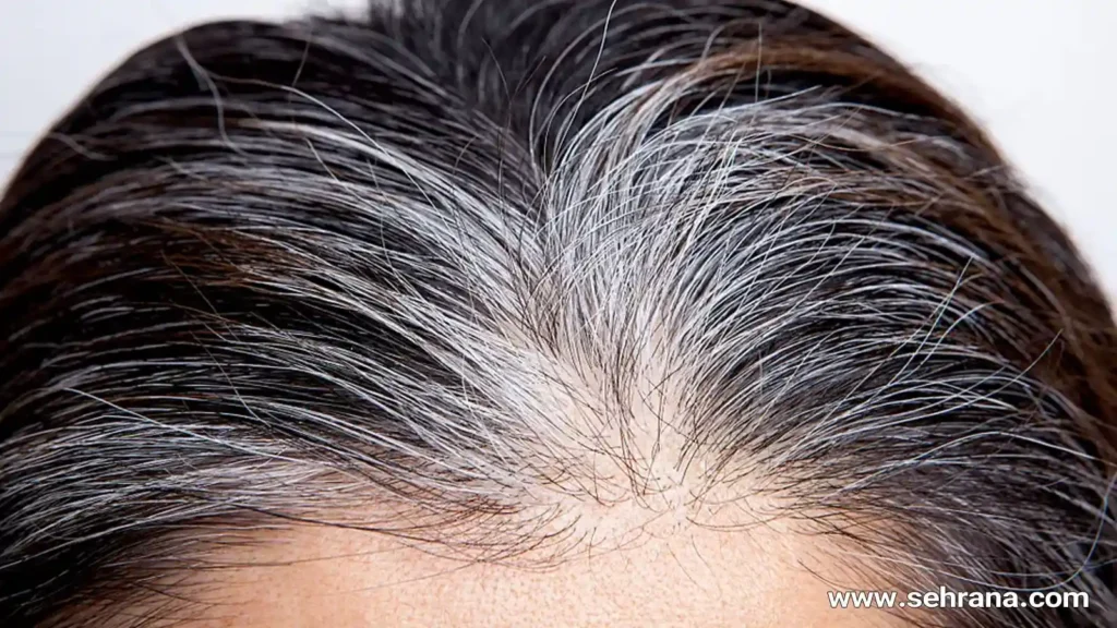 درمان گیاهی سفیدی مو